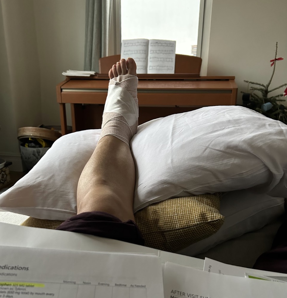 Maryann's bandaged foot propped on pillows after surgery, next to the after-visit paperwork